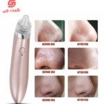 دستگاه میکرودرم خانگی مدل XN-8030