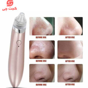 دستگاه میکرودرم خانگی مدل XN-8030